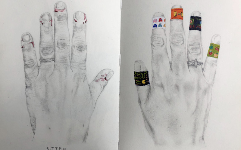 Image: Hands, one with bleeding wounds and one with bandaids.